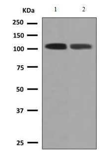 Western blot - Anti-PDE2A antibody [EPR9688] (AB140650)