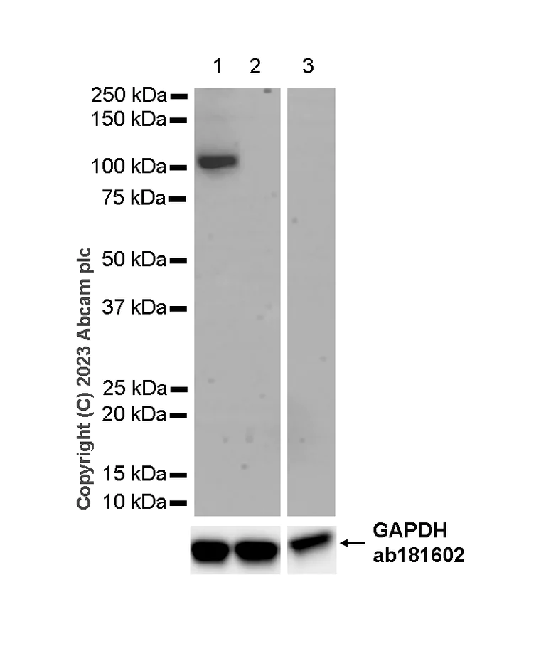 Western blot - Anti-PDE2A antibody [EPR9688] (AB140650)