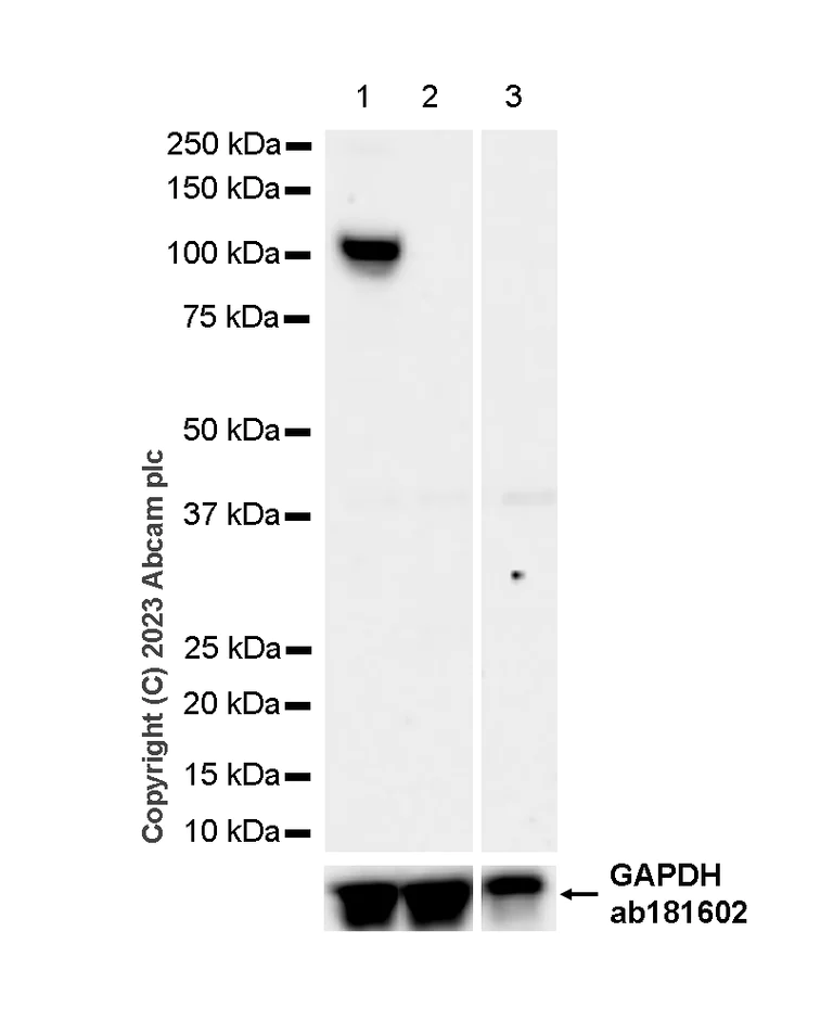Western blot - Anti-PDE2A antibody [EPR9688] (AB140650)