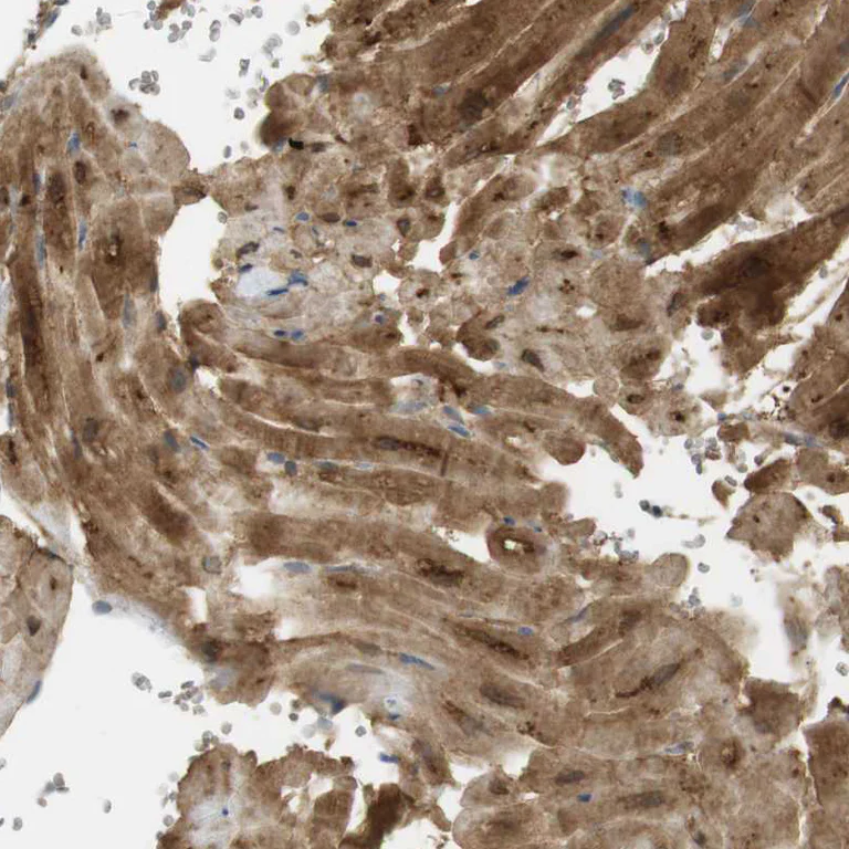 Immunohistochemistry (Formalin/PFA-fixed paraffin-embedded sections) - Anti-PDE3A antibody (AB244337)