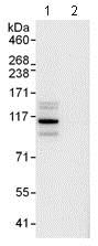 Immunoprecipitation - Anti-PDE3A antibody (AB99236)