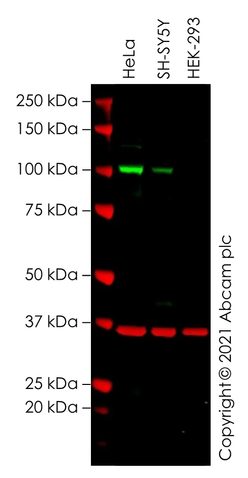 Western blot - Anti-PDE3A antibody (AB99236)