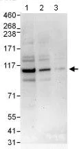 Western blot - Anti-PDE3A antibody (AB99236)