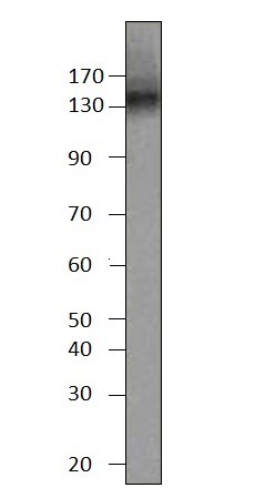 Western blot - Anti-PDE3B antibody (AB42091), expandable thumbnail