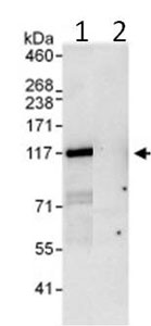 Immunoprecipitation - Anti-PDE3B antibody (AB99289)