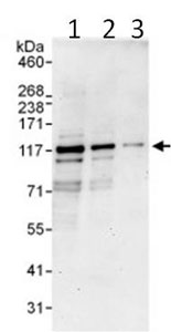 Western blot - Anti-PDE3B antibody (AB99289)