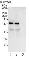 Immunoprecipitation - Anti-PDE3B antibody (AB99290), expandable thumbnail