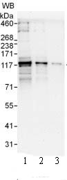 Western blot - Anti-PDE3B antibody (AB99290), expandable thumbnail