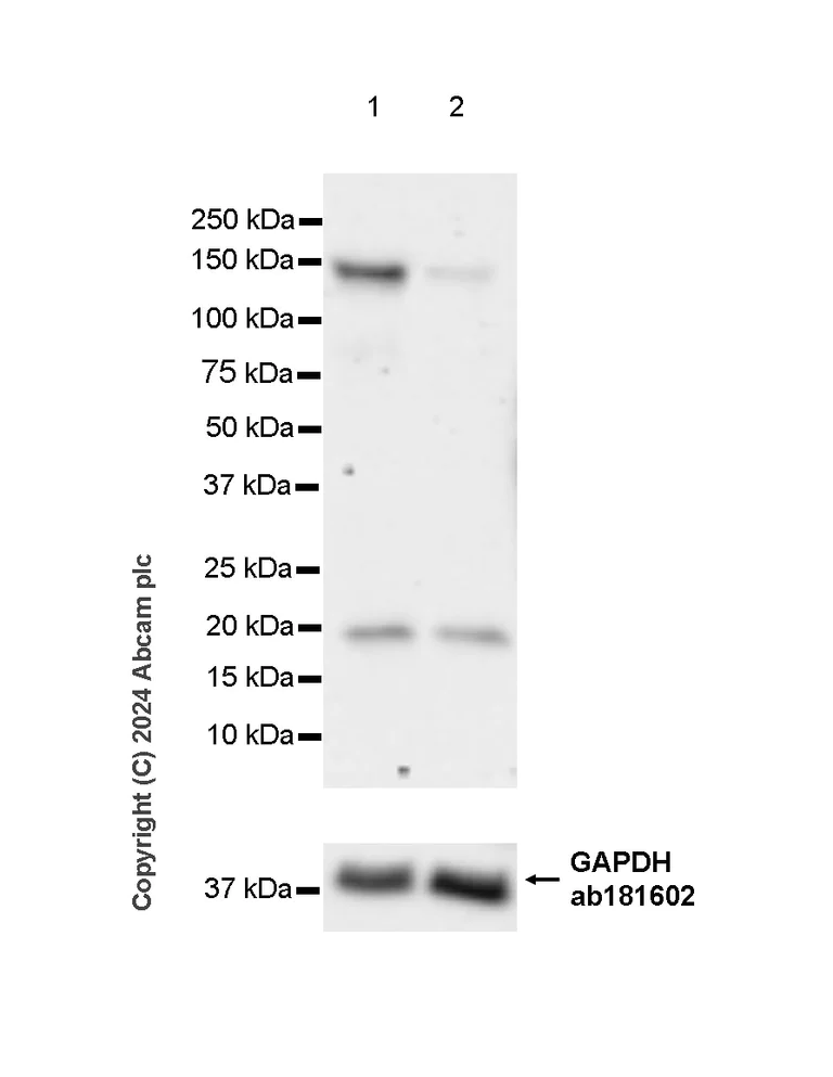 Western blot - Anti-PDE3B antibody [EPR28229-71] - BSA and Azide free (AB317027)