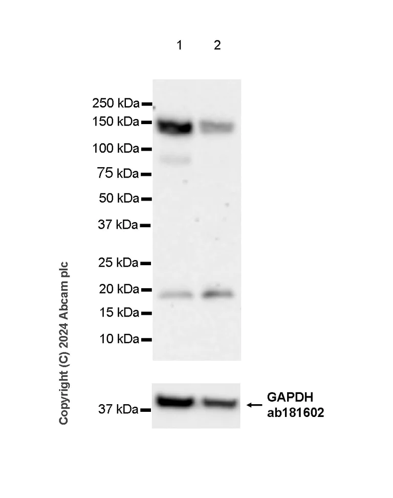Western blot - Anti-PDE3B antibody [EPR28229-71] - BSA and Azide free (AB317027)
