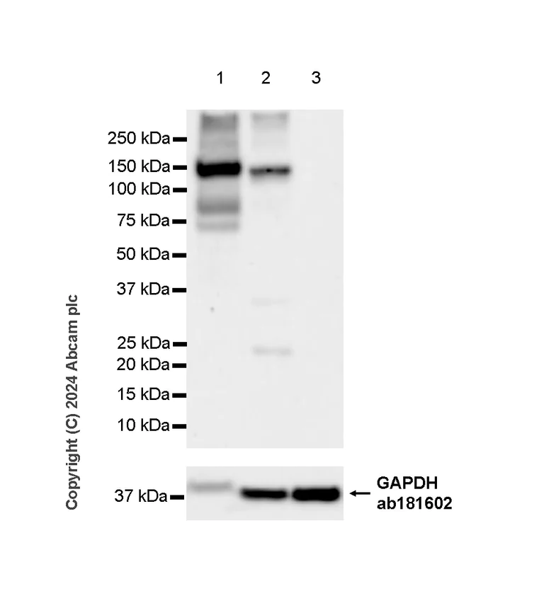 Western blot - Anti-PDE3B antibody [EPR28229-71] - BSA and Azide free (AB317027)