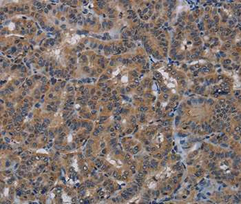 Immunohistochemistry (Formalin/PFA-fixed paraffin-embedded sections) - Anti-PDE4A antibody (AB200383)