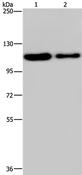 Western blot - Anti-PDE4A antibody (AB200383), expandable thumbnail
