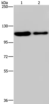 Western blot - Anti-PDE4A antibody (AB200383)