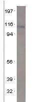 Western blot - Anti-PDE4A antibody (AB42094), expandable thumbnail
