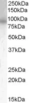 Western blot - Anti-PDE4B antibody (AB112014)