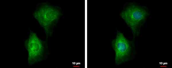 Immunocytochemistry/ Immunofluorescence - Anti-PDE4B antibody (AB228012), expandable thumbnail