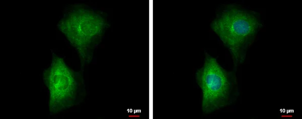 Immunocytochemistry/ Immunofluorescence - Anti-PDE4B antibody (AB228012)