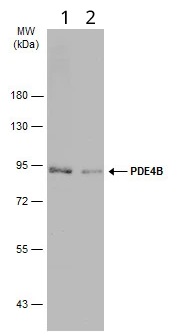 Western blot - Anti-PDE4B antibody - C-terminal (AB228901)