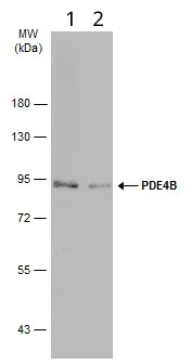 Western blot - Anti-PDE4B antibody - C-terminal (AB228901)