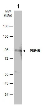 Western blot - Anti-PDE4B antibody - C-terminal (AB228901)