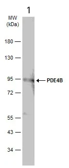 Western blot - Anti-PDE4B antibody - C-terminal (AB228901)