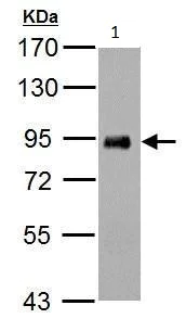 Western blot - Anti-PDE4B antibody - C-terminal (AB228901)