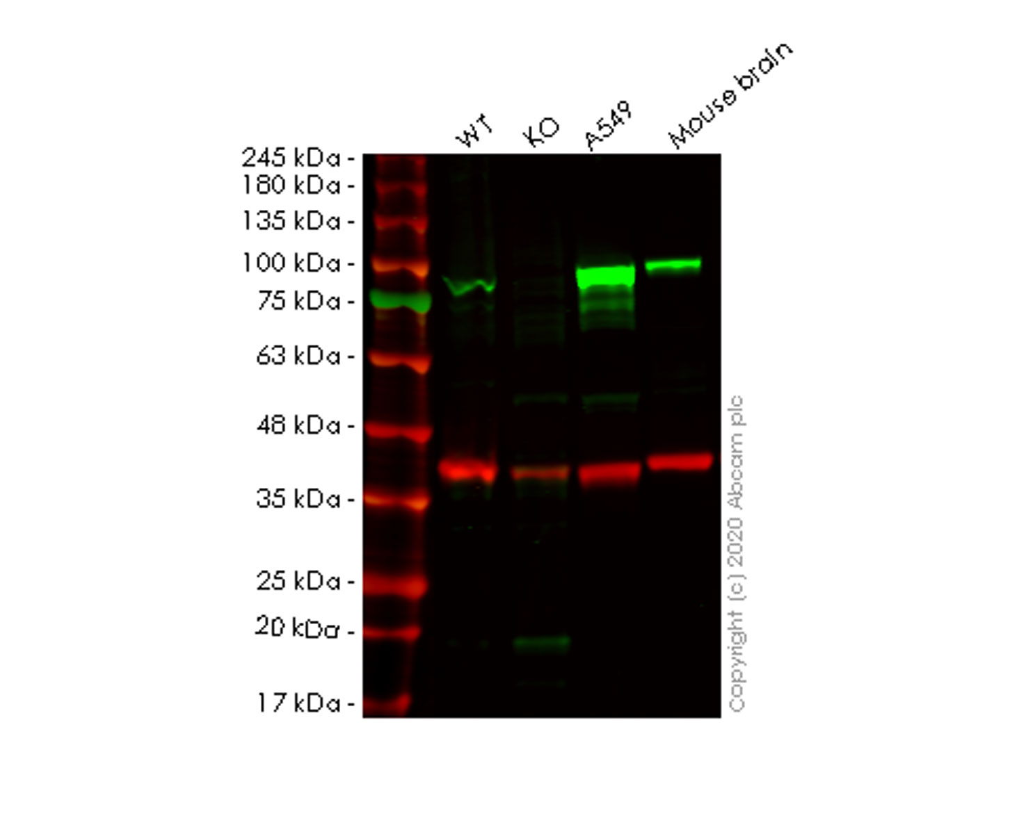 Western blot - Anti-PDE4B antibody [EPR11830] (AB170939), expandable thumbnail