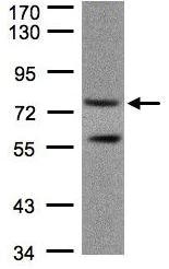 Western blot - Anti-PDE4C antibody (AB97356)