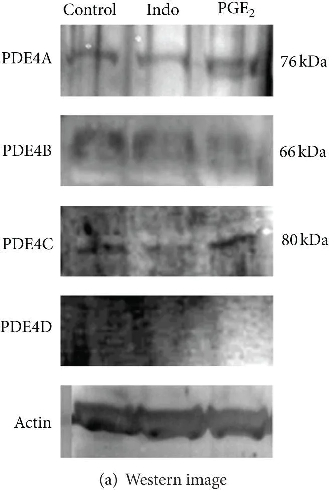 Western blot - Anti-PDE4C antibody (AB97356)