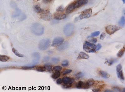 Immunohistochemistry (Formalin/PFA-fixed paraffin-embedded sections) - Anti-PDE4D antibody (AB14613)