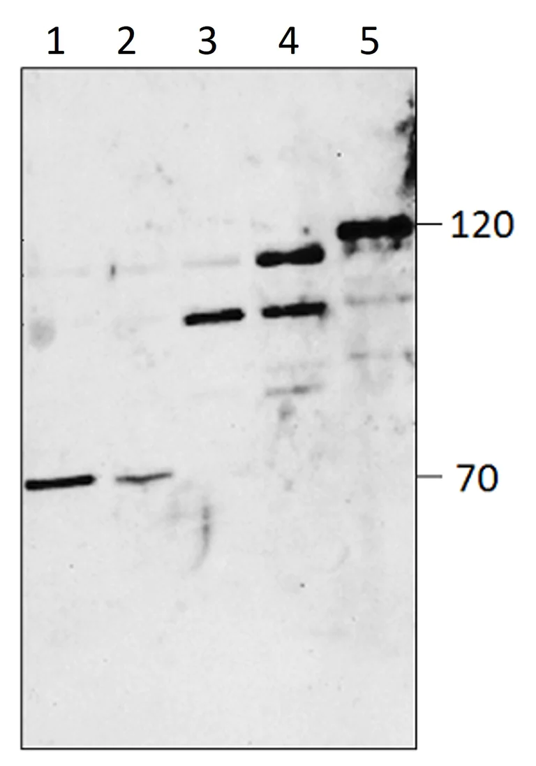 Western blot - Anti-PDE4D antibody (AB14613)