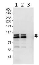 Immunoprecipitation - Anti-PDE4D antibody (AB99409)