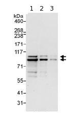 Western blot - Anti-PDE4D antibody (AB99409)