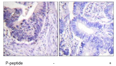 Immunohistochemistry (Formalin/PFA-fixed paraffin-embedded sections) - Anti-PDE4D (phospho S190) antibody (AB59212)