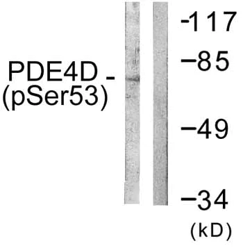 Western blot - Anti-PDE4D (phospho S190) antibody (AB59212)