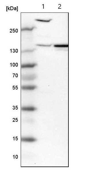 Western blot - Anti-PDE4DIP antibody (AB121275), expandable thumbnail