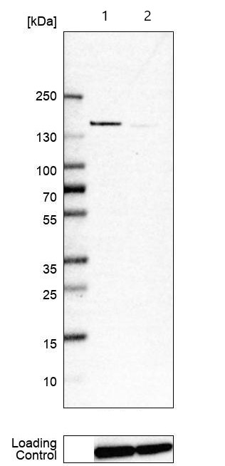 Western blot - Anti-PDE4DIP antibody (AB121275), expandable thumbnail