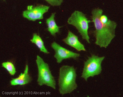 Immunocytochemistry/ Immunofluorescence - Anti-PDE5A/PDE5 antibody (AB14672)