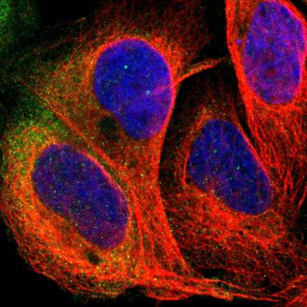 Immunocytochemistry/ Immunofluorescence - Anti-PDE5A/PDE5 antibody (AB224232), expandable thumbnail