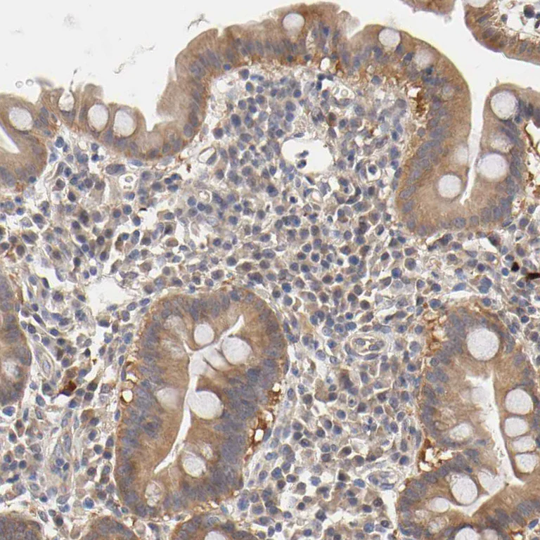 Immunohistochemistry (Formalin/PFA-fixed paraffin-embedded sections) - Anti-PDE5A/PDE5 antibody (AB224232)