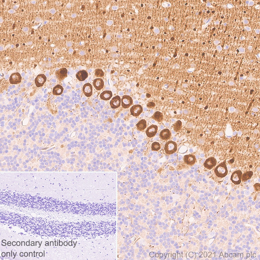 Immunohistochemistry (Formalin/PFA-fixed paraffin-embedded sections) - Anti-PDE5A/PDE5 antibody [EPR24129-95] (ab259945), expandable thumbnail