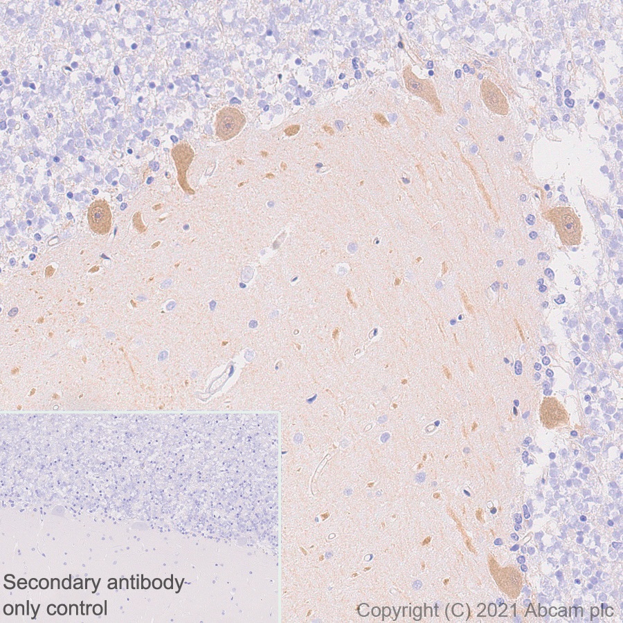 Immunohistochemistry (Formalin/PFA-fixed paraffin-embedded sections) - Anti-PDE5A/PDE5 antibody [EPR24129-95] (AB259945), expandable thumbnail