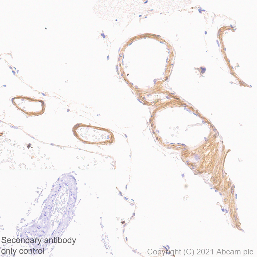 Immunohistochemistry (Formalin/PFA-fixed paraffin-embedded sections) - Anti-PDE5A/PDE5 antibody [EPR24129-95] (AB259945), expandable thumbnail