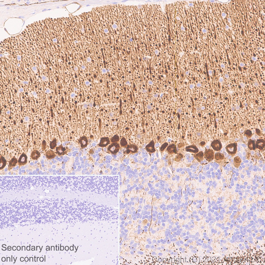 Immunohistochemistry (Formalin/PFA-fixed paraffin-embedded sections) - Anti-PDE5A/PDE5 antibody [EPR24129-95] (AB259945), expandable thumbnail