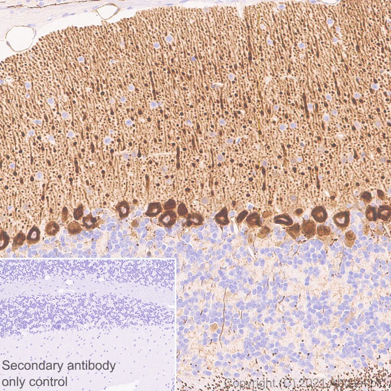 Immunohistochemistry (Formalin/PFA-fixed paraffin-embedded sections) - Anti-PDE5A/PDE5 antibody [EPR24129-95] (AB259945)