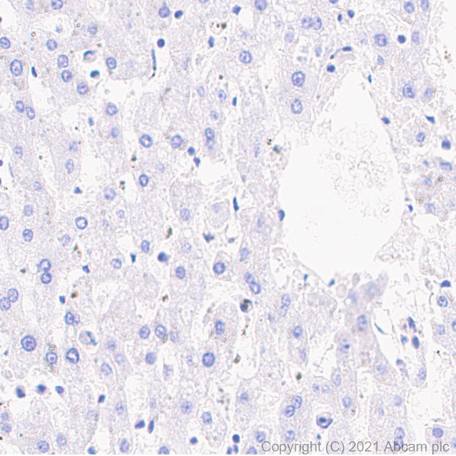Immunohistochemistry (Formalin/PFA-fixed paraffin-embedded sections) - Anti-PDE5A/PDE5 antibody [EPR24129-95] (ab259945), expandable thumbnail
