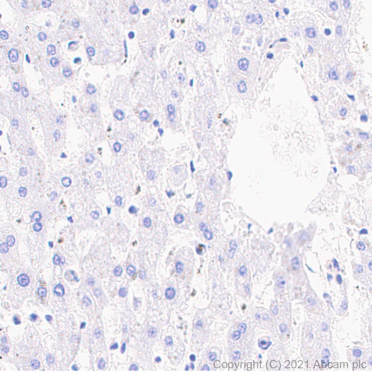 Immunohistochemistry (Formalin/PFA-fixed paraffin-embedded sections) - Anti-PDE5A/PDE5 antibody [EPR24129-95] (AB259945)