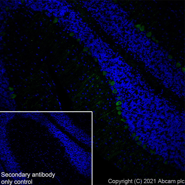 Immunohistochemistry (Frozen sections) - Anti-PDE5A/PDE5 antibody [EPR24129-95] (ab259945), expandable thumbnail