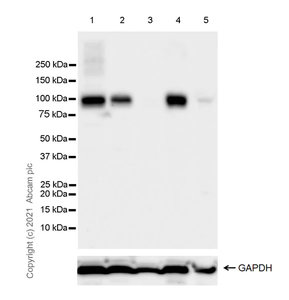 Western blot - Anti-PDE5A/PDE5 antibody [EPR24129-95] (AB259945)